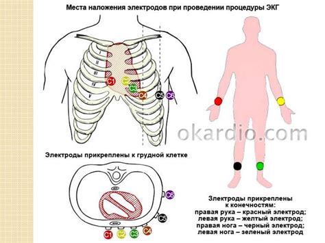 Проведение ЭКГ обследования: шаги и подготовка