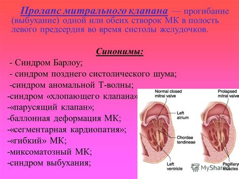 Прогибание пространства