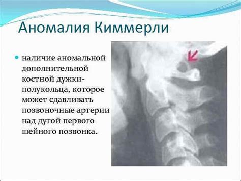 Происхождение неполной двусторонней аномалии Киммерли