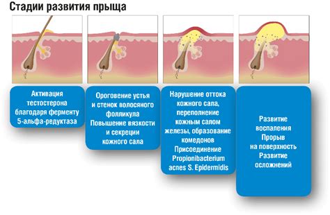 Промежуточное расположение прыща: что происходит в организме?