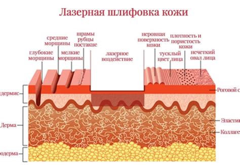 Профессиональные способы избавления