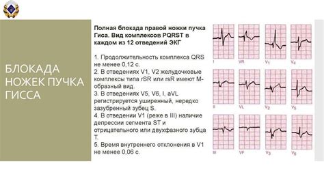 Профилактика блокады сердца у ребенка