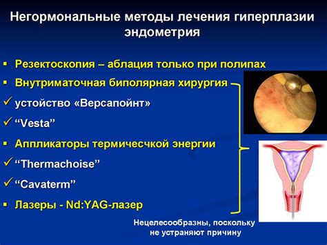 Профилактика гиперплазии желудка