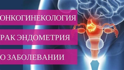 Профилактика нарушения дифференцировки эндометрия