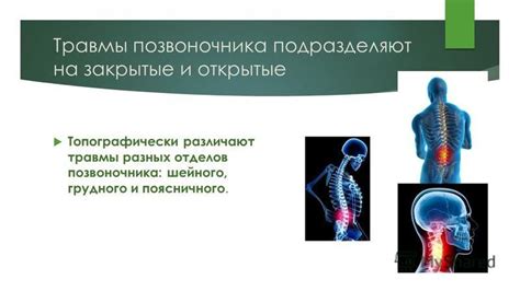 Профилактика нарушения статики позвоночного столба