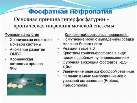 Профилактика нефропатии у мужчин