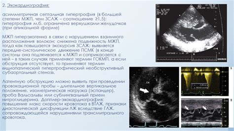 Профилактика повышенной эхогенности миометрия