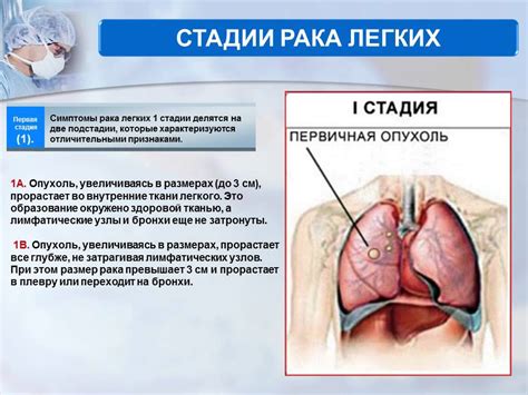 Профилактика порождения легких