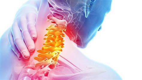 Профилактика проблем с шейным отделом позвоночника