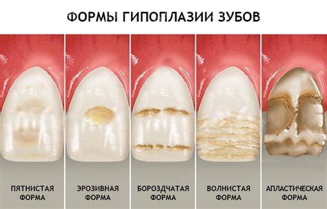 Профилактика пульсирующего зуба