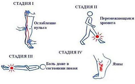 Профилактика рубца от язвы