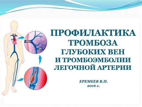 Профилактика эмболии легочной артерии