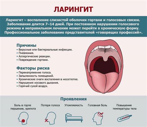 Профилактические меры для предотвращения ангины