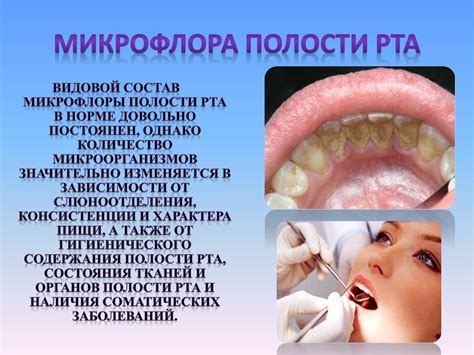 Проффесиональные особенности, способствующие развитию особого шороха в полости рта