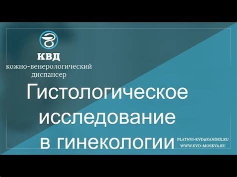 Процедура гистологического выскабливания матки