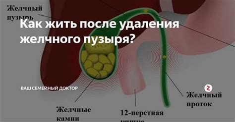 Процесс выполняется после удаления плода.