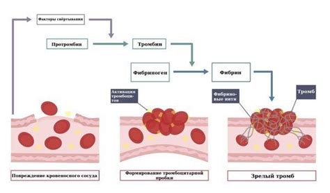 Процесс образования тромбов и применение гепарина
