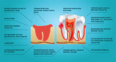 Процесс удаления и освобождения зуба и его значения в сновидениях