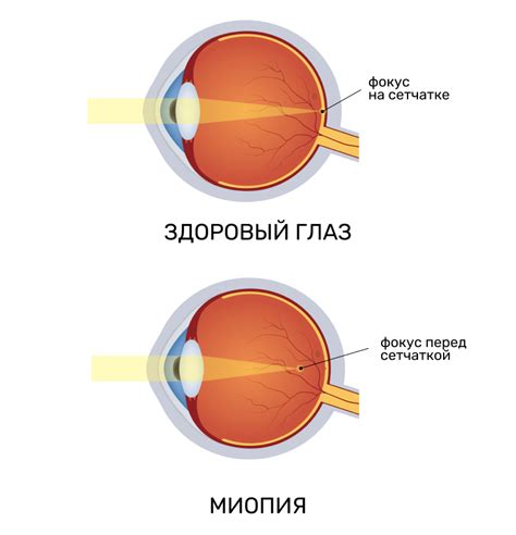 Проявление злобы в глазах