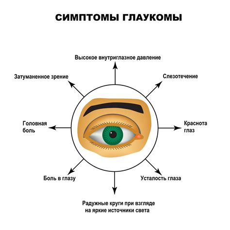 Проявления глаукомы: основные симптомы и диагностика