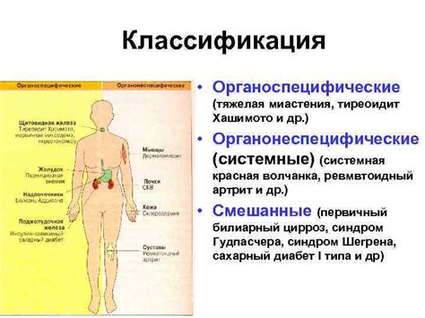 Проявления пресыщения у человека