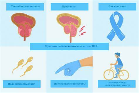 Пса общественного использования - что это значит?