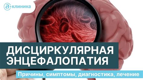 Психологическая помощь пациентам с энцефалопатией сосудистого генеза