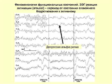 Психологические аспекты ослабления активации ЭЭГ