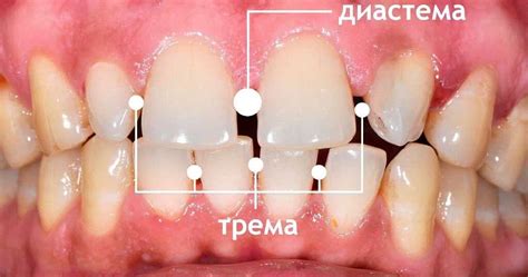 Психологический анализ сна: связь между движением зубов и эмоциональным состоянием