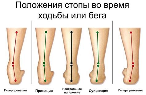 Пульпирование кисти: что это такое?