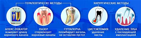 Пульпит перестал болеть: причины и значения