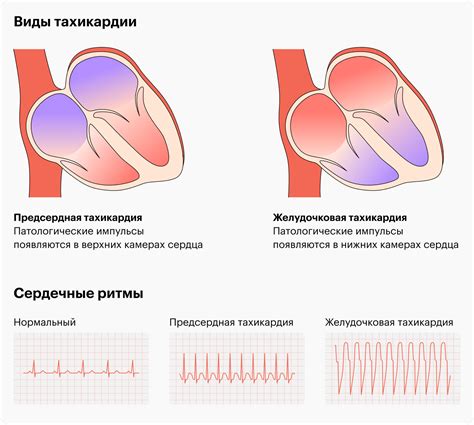 Пульс в состоянии покоя