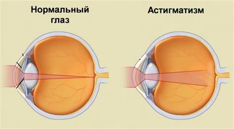 Раздел: Восстановление ослабленной зрительной помощи