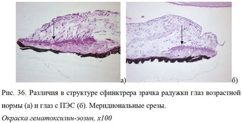 Различия в мышечной структуре глаз