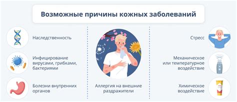 Различные причины ретирования