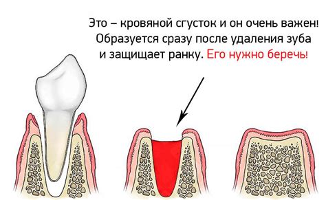 Разнообразные трактовки извлечения зуба в сновидениях