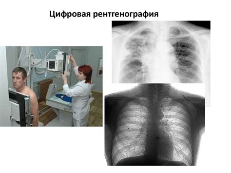 Разрушение легочной ткани: причины и механизмы