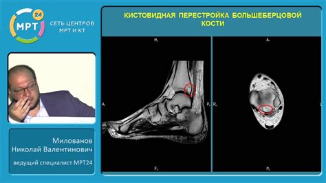 Ранние симптомы начальных дегенеративно-дистрофических изменений