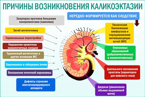 Раскрытие почек: знаки, причины и методы лечения