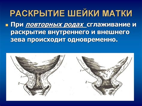 Раскрытие цервикального канала во время родов