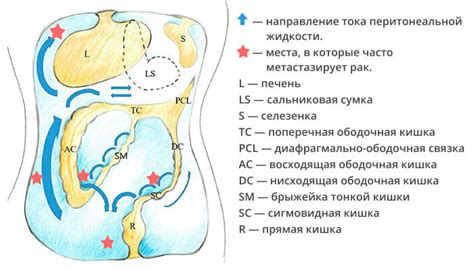 Распространение метастазов по организму