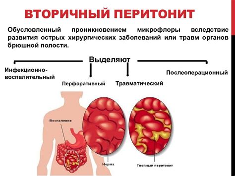 Рассмотрим основные заболевания, приводящие к чиханию кровью