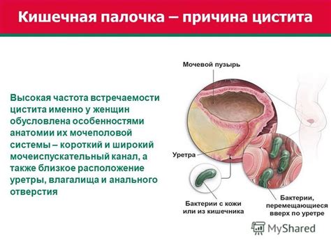 Расстройства локуса уретры и их симптомы