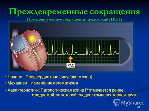 Расстройство сердечного ритма: возможные осложнения