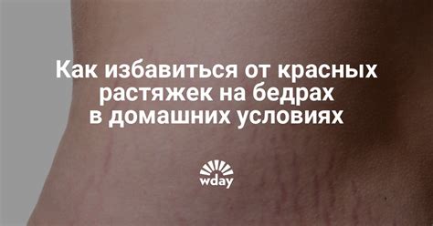 Растяжки на ягодицах: как с ними бороться?