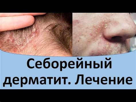 Регулярное массажирование кожи головы