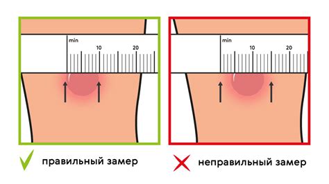 Результаты вираж пробы манту и их интерпретация