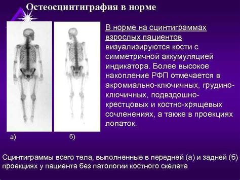 Результаты использования скелета