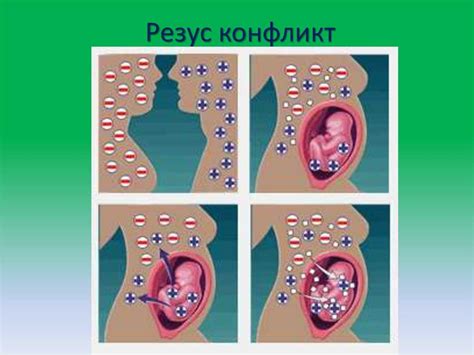 Резус-конфликт у ребенка: причины, симптомы, лечение