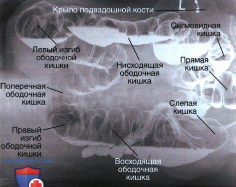 Рекомендации по поддержанию здоровья толстой кишки